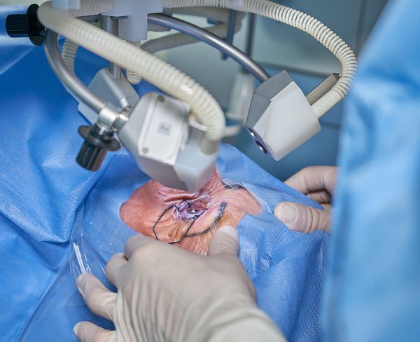 Chirurgie des paupières : rajeunissez votre regard en toute sécurité